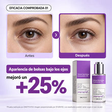 Antes y después: apariencia de bolsas bajo los ojos