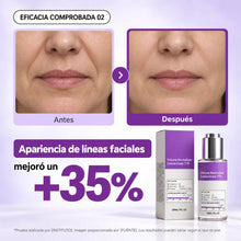 Antes y después: apariencia de líneas faciales