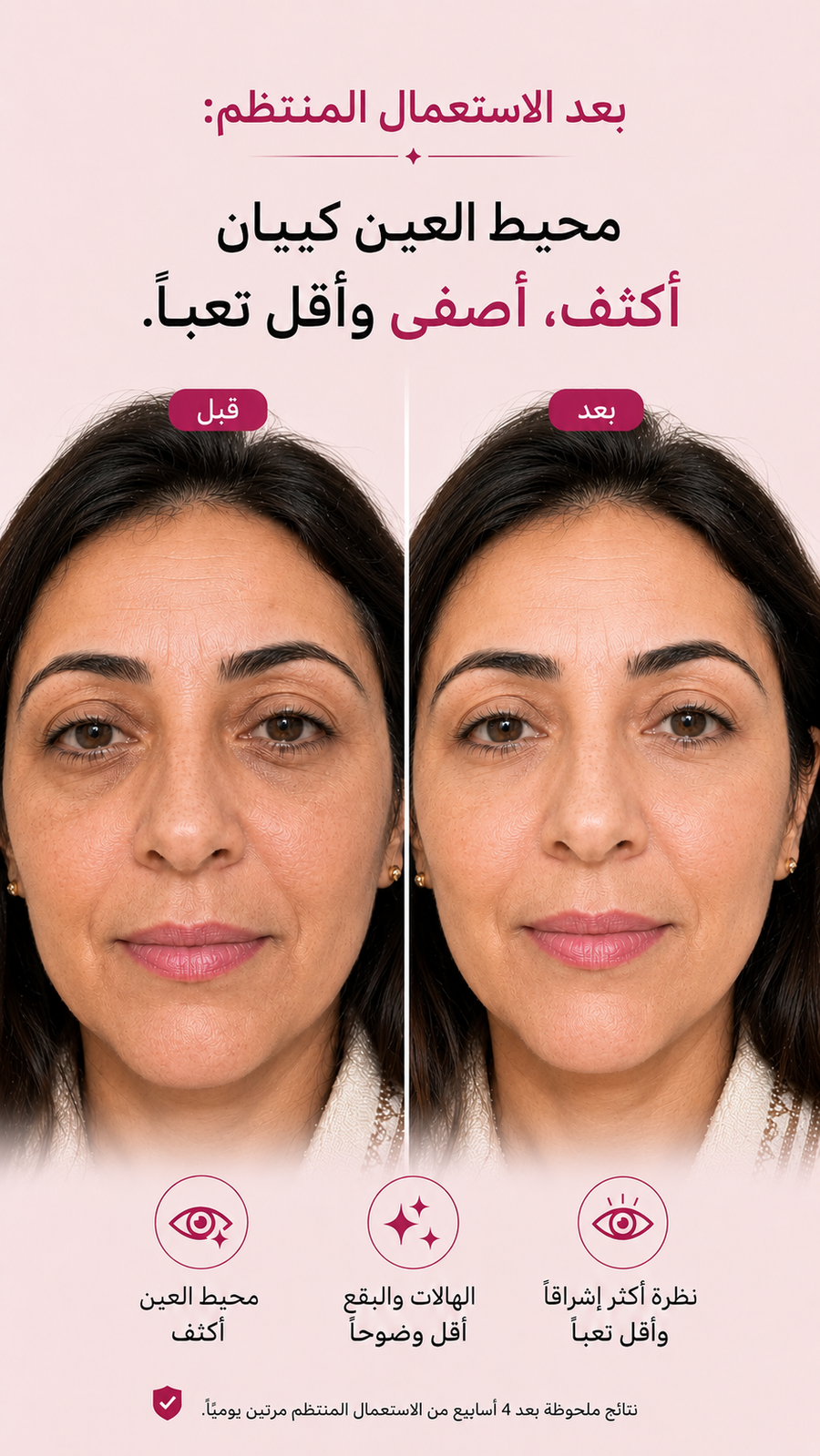 كيخفّف الهالات السوداء و كيرجّع الإشراق للعينين