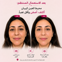 كريم العيون بالكالسيوم
