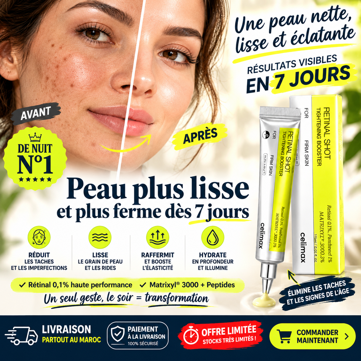 Retinal Shot : votre rituel du soir peut commencer cette semaine