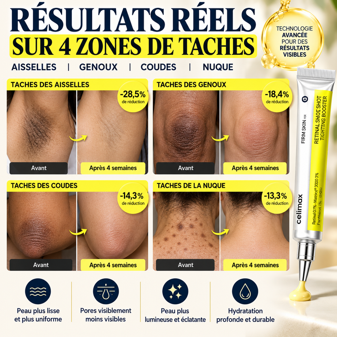 Aisselles, coudes, genoux, nuque : ciblez la zone, pas tout le corps