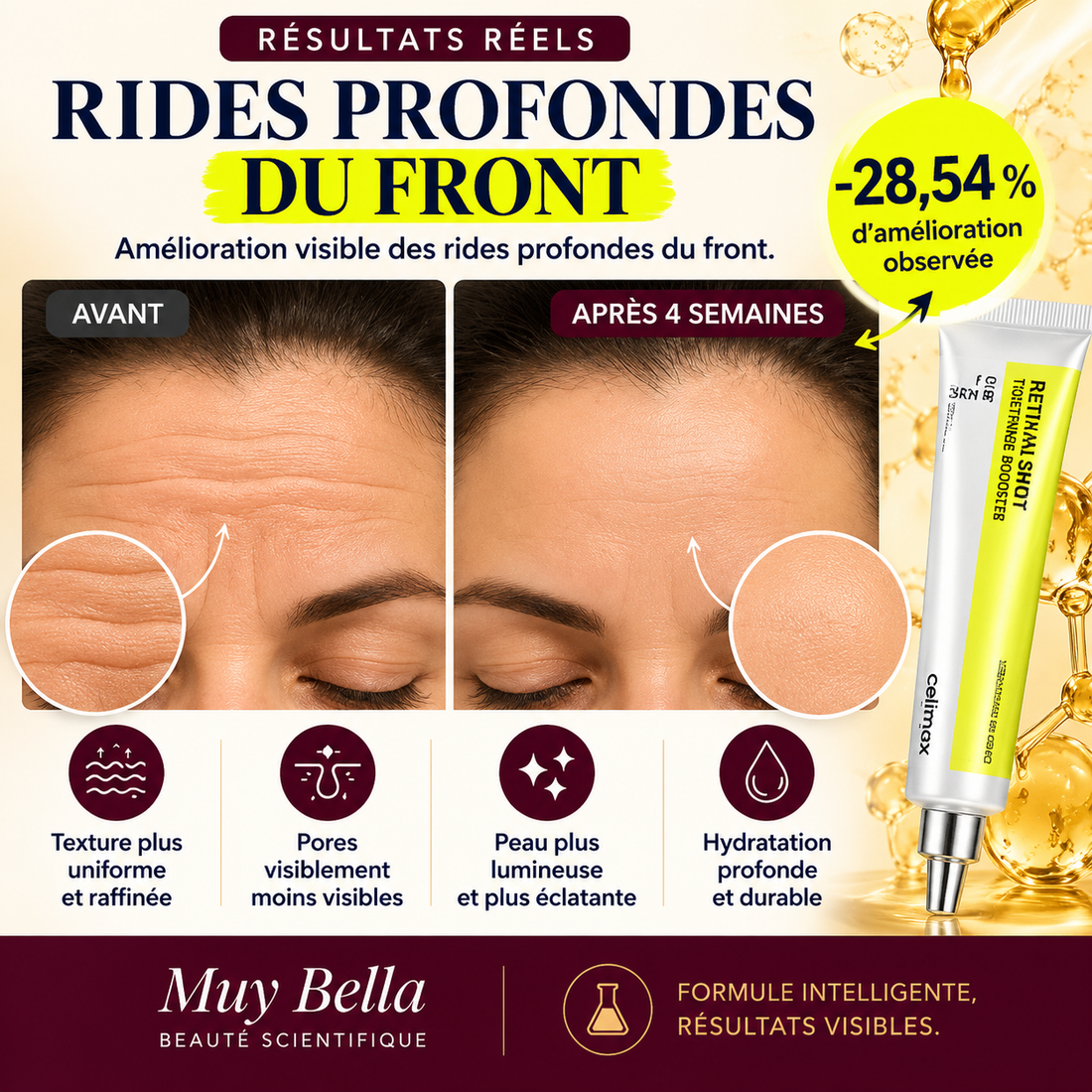 Le front, la zone qui marque en premier