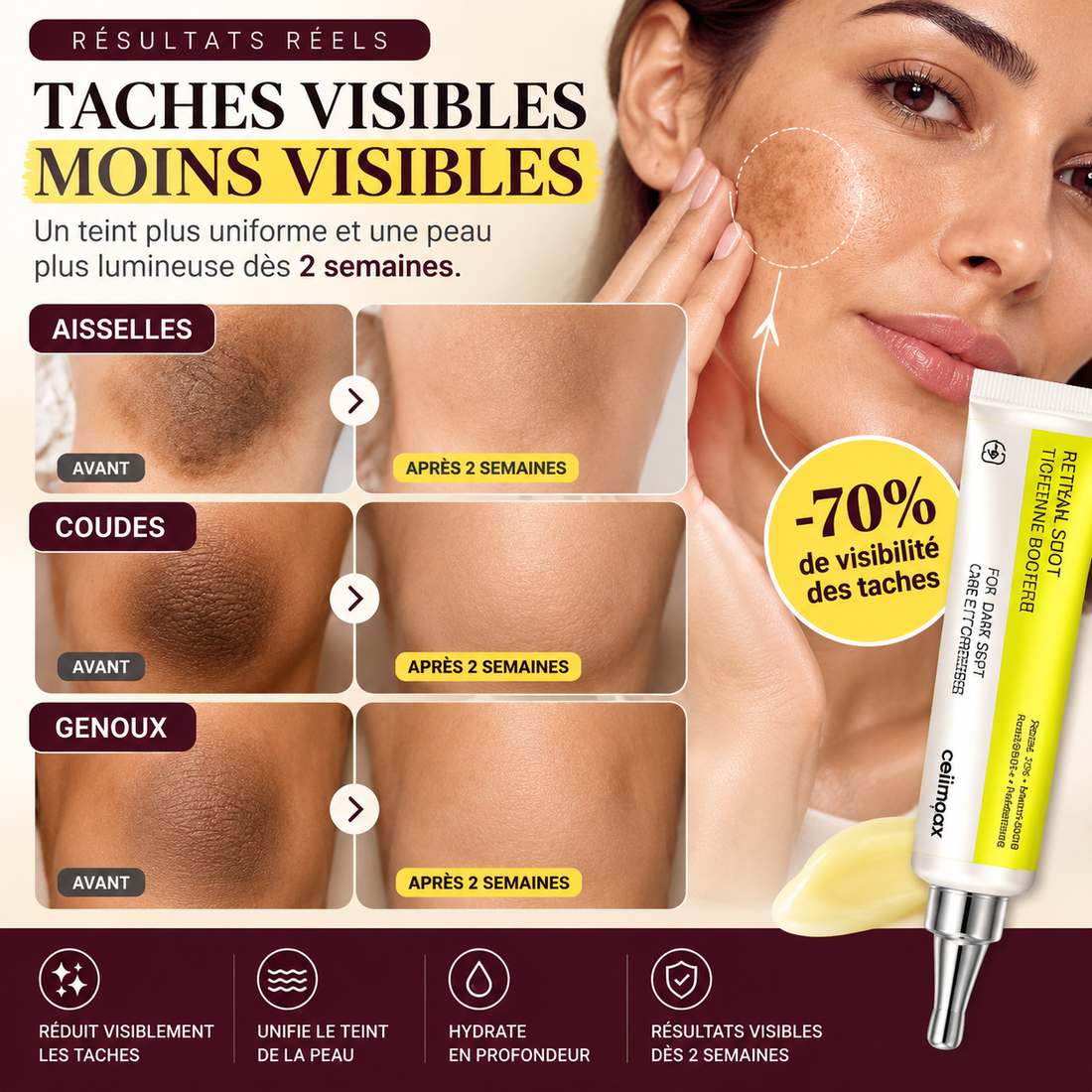 Taches de soleil, marques de boutons : une goutte juste dessus